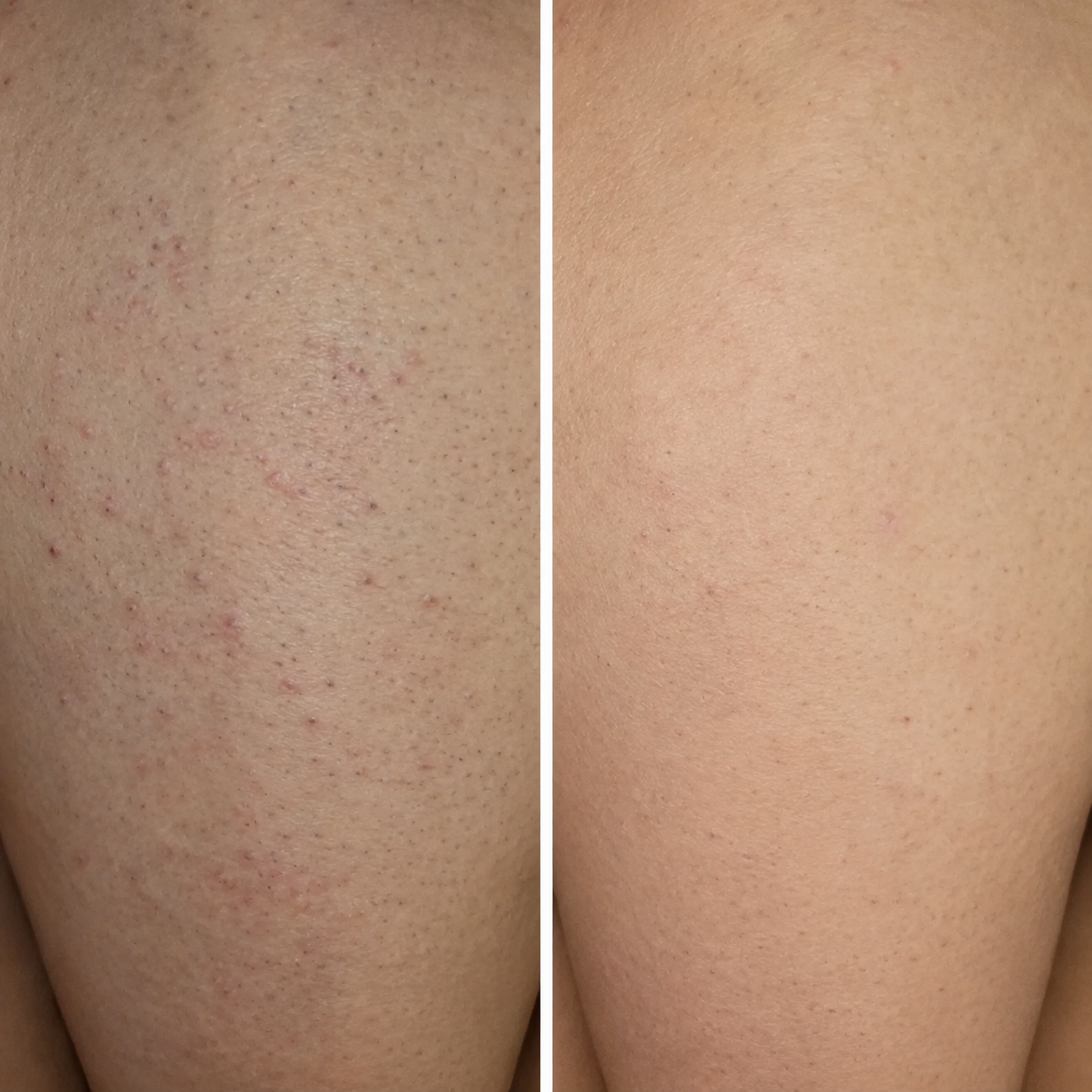 Skin Serum — Cyperus Rotundus