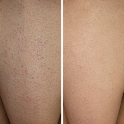 Skin Serum — Cyperus Rotundus